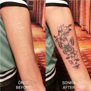 Kelebek ve iekler ile Yara Kesik zi Kapatma / Scar Tattoo